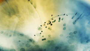 Développement des transports en commun à Clichy-sous-Bois – amélioration des liaisons